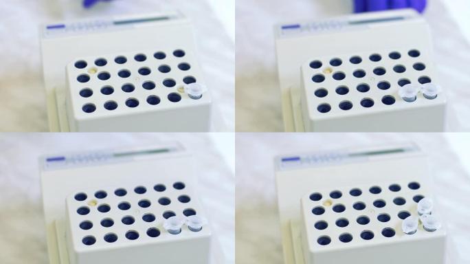 实验室工作人员将样品放入托盘中，在医学实验室中分析免疫病毒