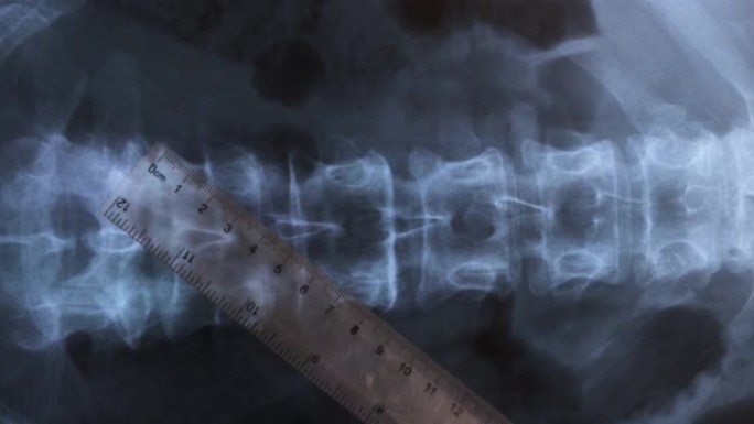 人体脊柱骨骼的x射线，4K