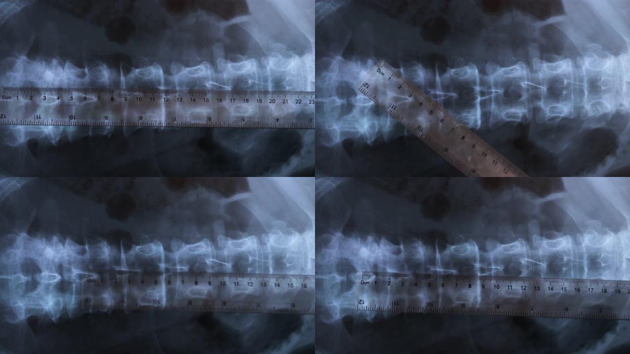 人体脊柱骨骼的x射线，4K