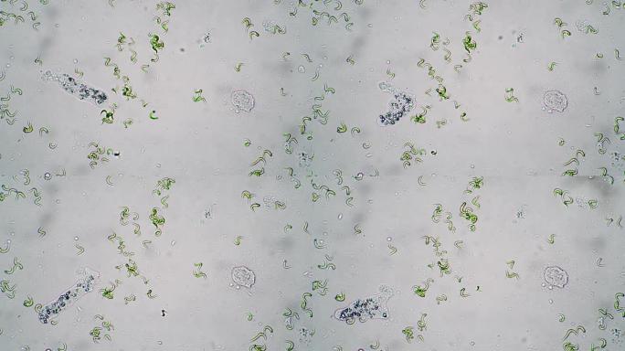 变形虫的微观世界在藻类近距离间在水中移动