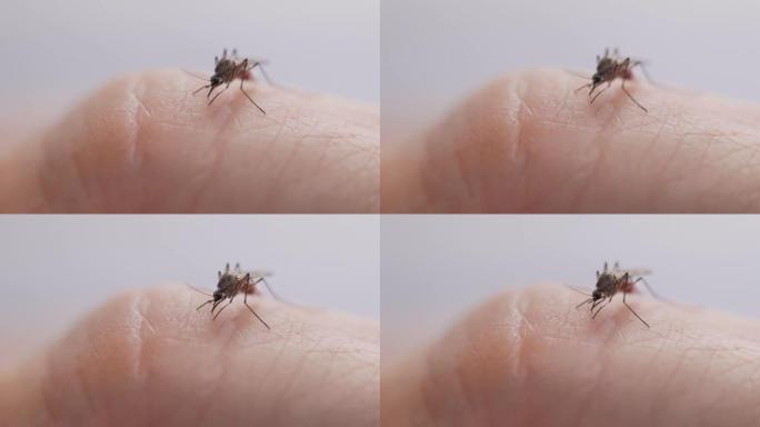 蚊子吸食人类血液蚊子吸食人类血液