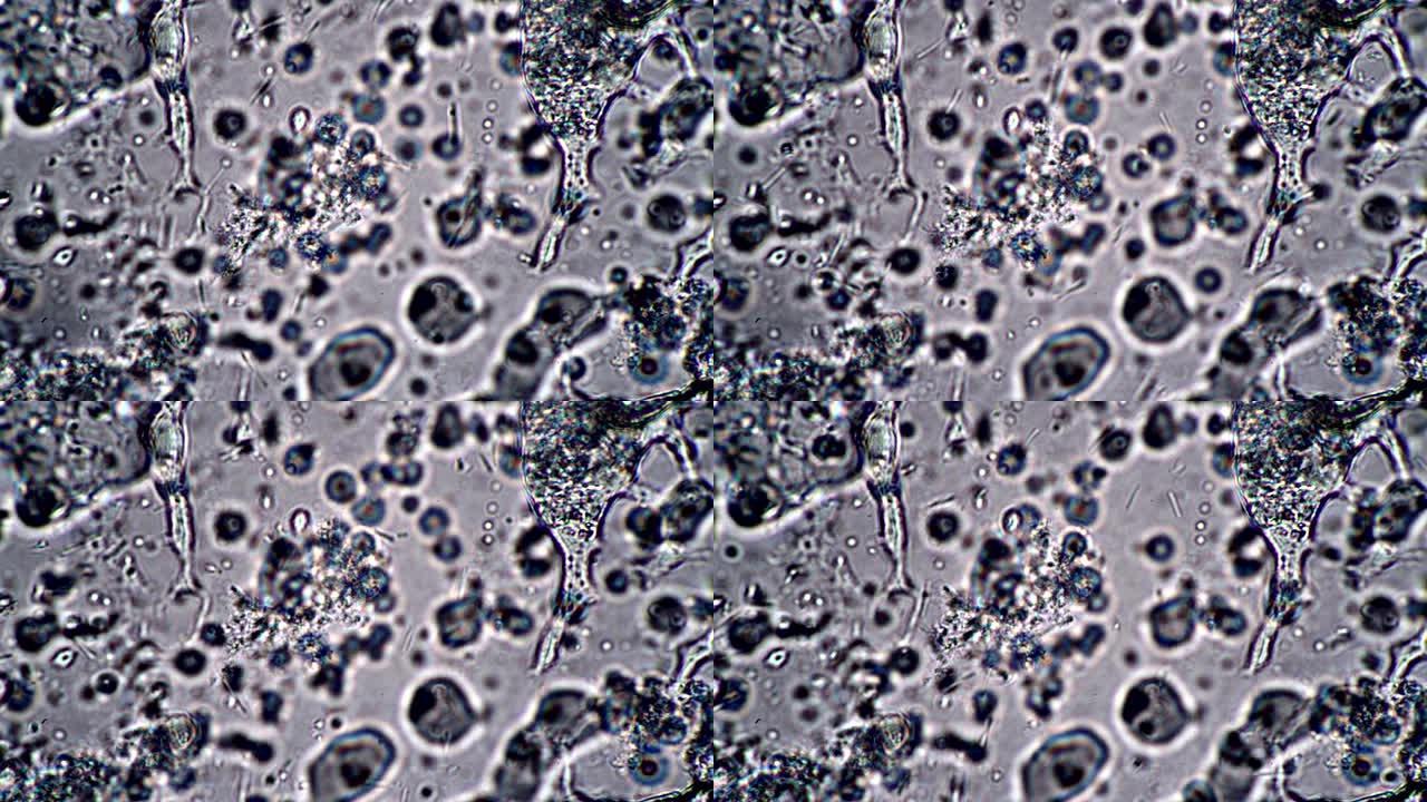 在显微镜下移动酸奶中的嗜酸乳杆菌和双歧杆菌