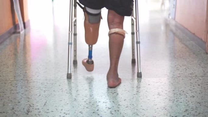 BKA患者通过假肢行走