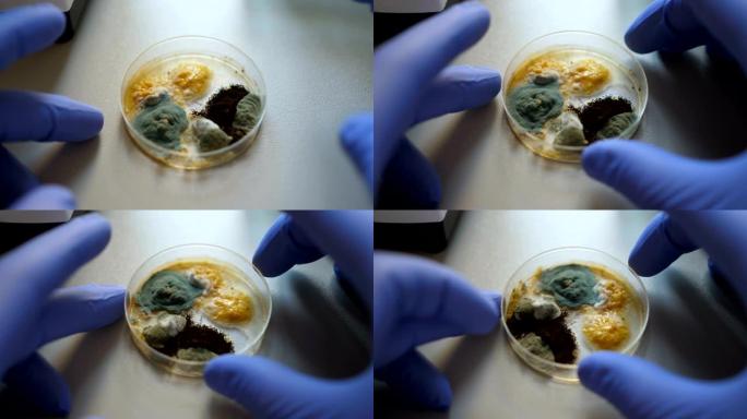 科学家在细菌培养中进行分析。特写镜头。化学实验室细菌培养皿。手拿蓝色手套的培养皿与霉菌和细菌菌落。科