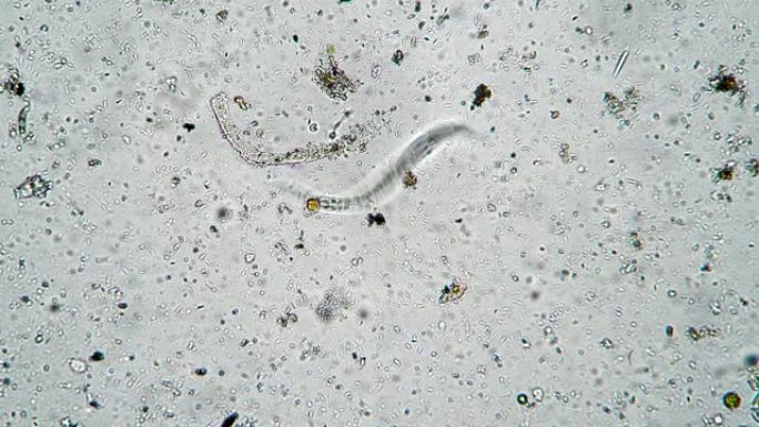 线虫在众多细菌和微生物簇之间移动