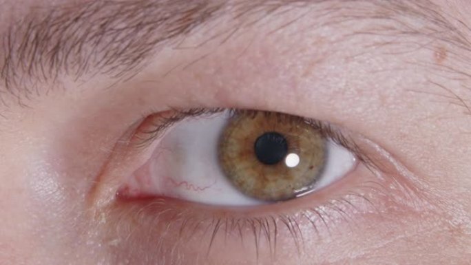 人类虹膜眼的极端宏观特写。逐渐减少的男人的瞳孔。有黄色和棕色的色素沉着。4k慢动作