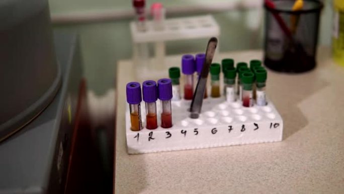 一名女实验室助理正在准备验血。现代医疗技术。医学实验室。