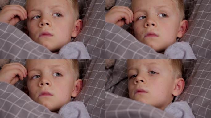 一个患水痘的小男孩躺在床上，抓挠脸上的皮肤
