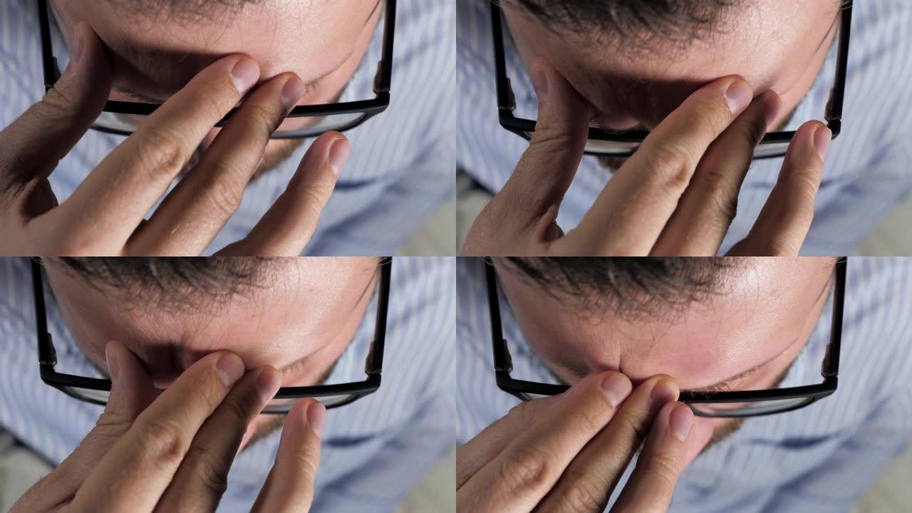 头痛。男人双手合眼触摸头。偏头痛，血压，压力，颅内压，眼乏力概念。顶视图。特写