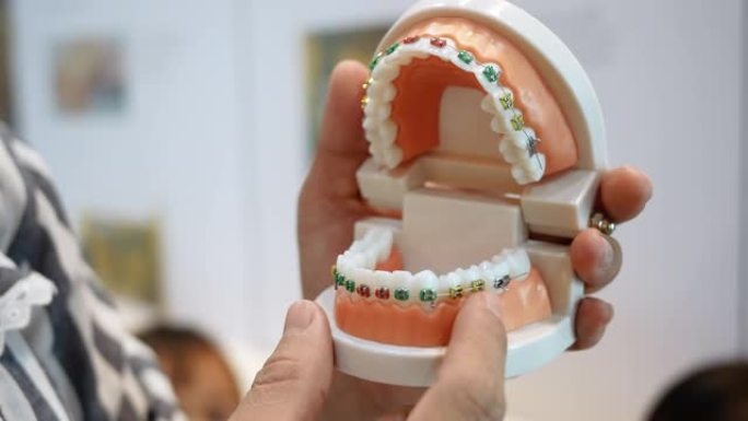 牙医手里拿着假牙，展示牙齿上的牙套系统是如何排列的。义齿学概念。