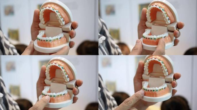 牙医手里拿着假牙，展示牙齿上的牙套系统是如何排列的。义齿学概念。