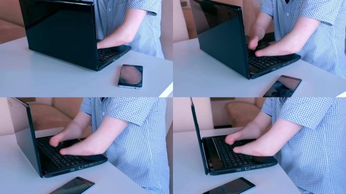 一个双手被截肢的残疾人在笔记本电脑上打字特写。