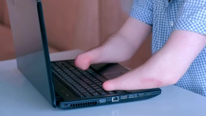 一个双手被截肢的残疾人在笔记本电脑上打字，特写镜头。
