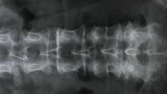 人体脊柱和骨盆骨骼的x射线，4K
