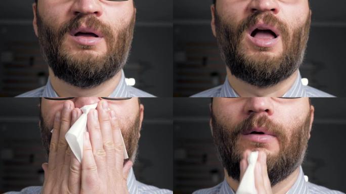 男人打喷嚏，用纸巾闭上嘴。过敏，猫毛，灰尘，感冒，流感，鼻炎概念。前视图。特写