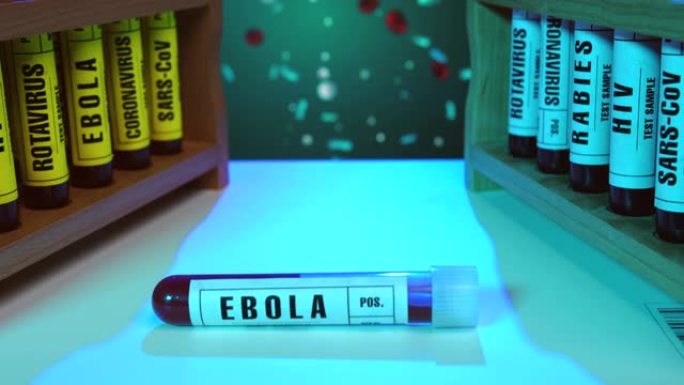 埃博拉病毒血液测试样本特写管
