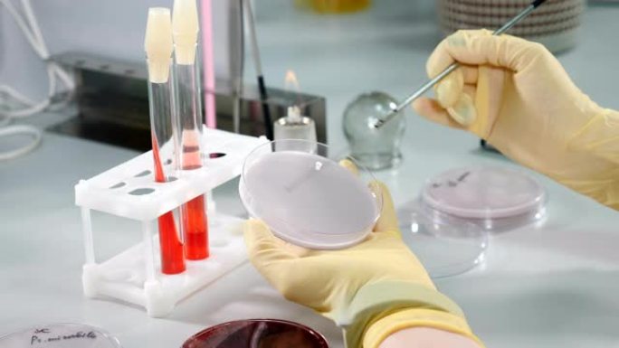 培养皿中的微生物实验室工作。带有细菌环的特写镜头微生物学家从培养皿中收集细菌培养物以进行分析。科学家