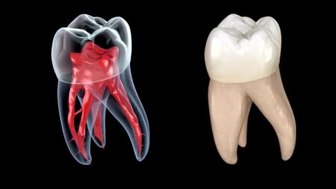 牙根解剖-第一上颌磨牙。医学上精确的牙科3D动画