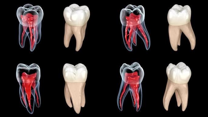 牙根解剖-第一上颌磨牙。医学上精确的牙科3D动画