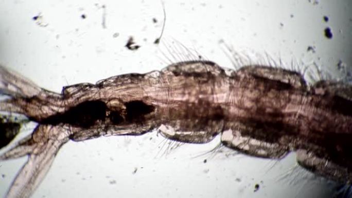 显微镜下蠕虫中微生物的排便