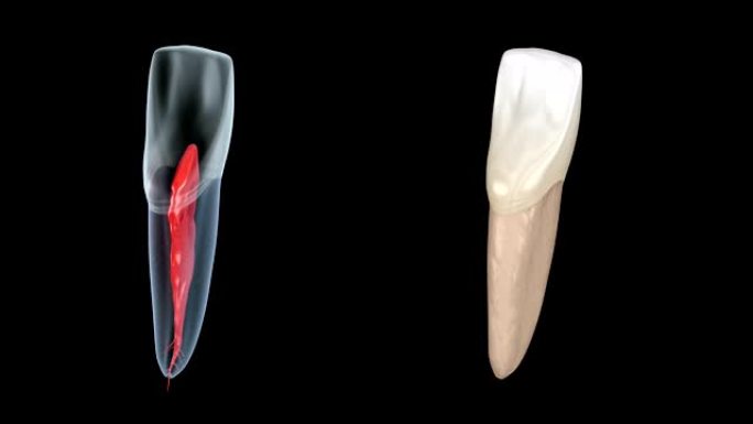 牙根解剖-中央上颌切牙。医学上精确的牙科3D动画