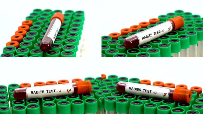 狂犬病病毒测试医学采样试管试剂血样