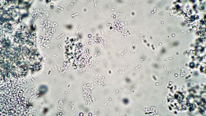 显微镜下的乳杆菌漂浮在培养物中