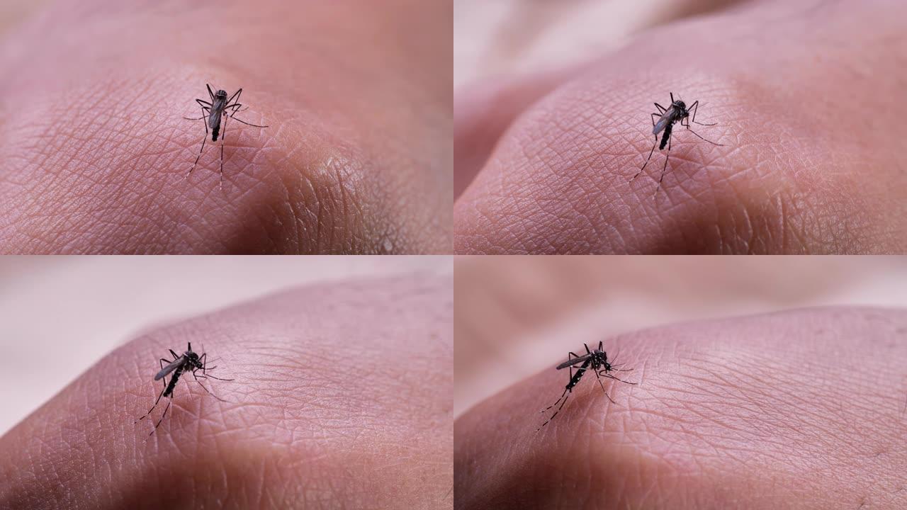 蚊子。花蚊子吸血皮肤特写过程