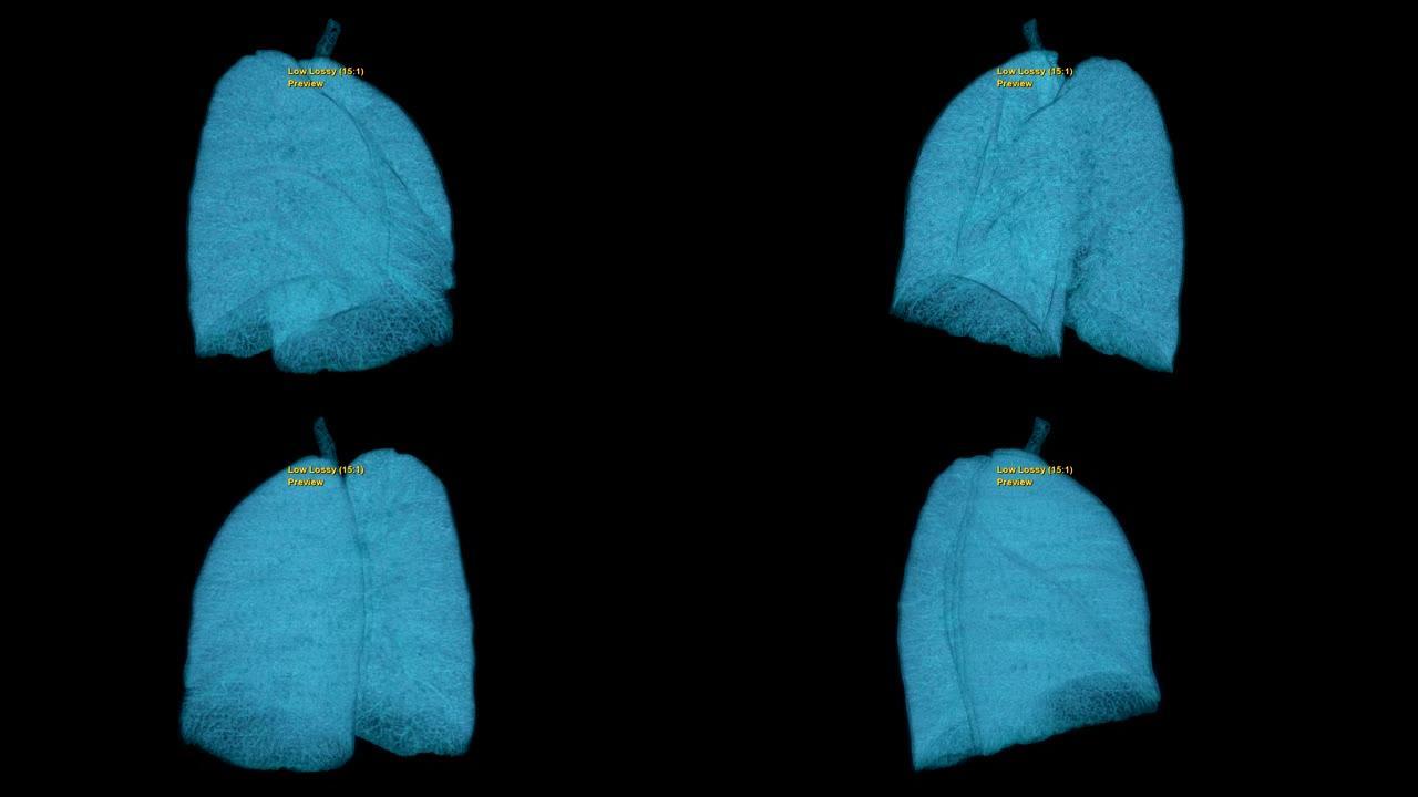 CT胸部或肺部三维渲染图像。