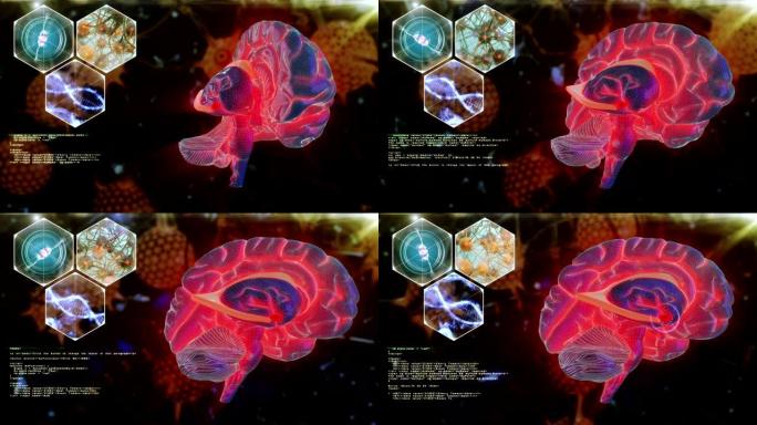 人体脑神经扫描人体脑神经扫描医学头脑大脑