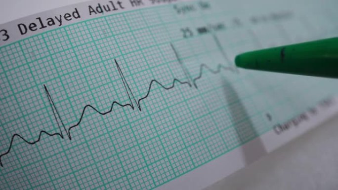心电图分析医疗科学检查