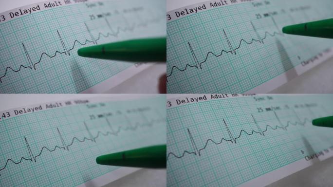 心电图分析医疗科学检查
