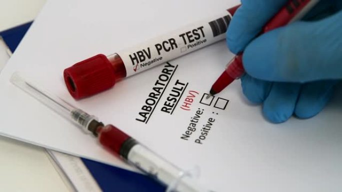 乙型肝炎病毒试验。HBV PCR血液检测