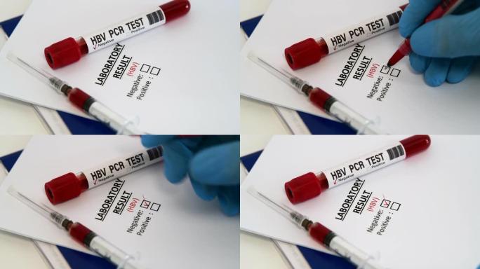乙型肝炎病毒试验。HBV PCR血液检测