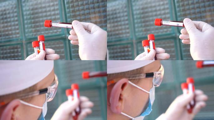 医生的简介看试管与血液样本冠状病毒。男性医生戴着防护眼镜，测试血液样本以新型冠状病毒肺炎病毒。大流行