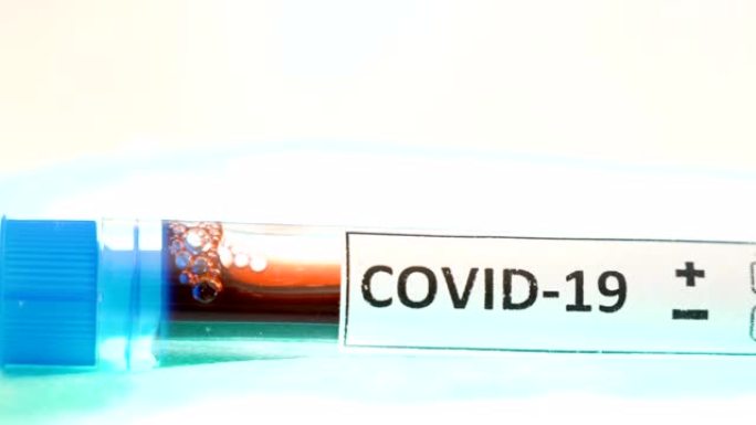 冠状病毒样品套件上的新型冠状病毒肺炎标志的仔细观察