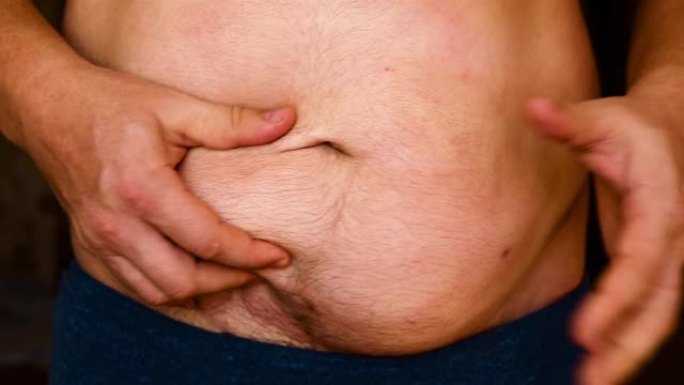 男人在肚子上露出脂肪