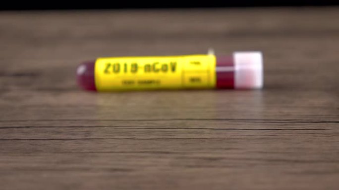 2019-nCOv (新型冠状病毒肺炎) 血液样本测试木桌，多莉镜头，4K