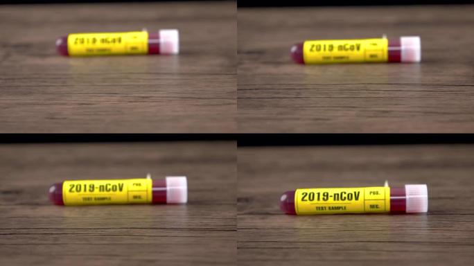 2019-nCOv (新型冠状病毒肺炎) 血液样本测试木桌，多莉镜头，4K