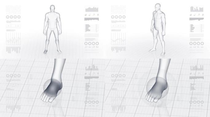 患有足部病理学的人。男孩的3d身体。男性人体结构的旋转动画和特写。4k镜头。