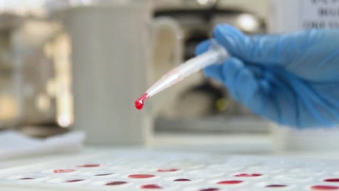 实验室工作人员拿着比色杯来定义血型和Rh因子