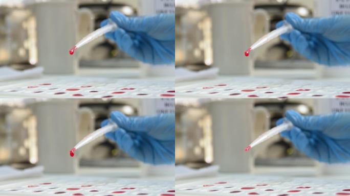 实验室工作人员拿着比色杯来定义血型和Rh因子