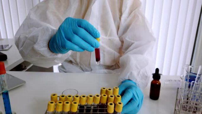 研究人员在实验室测试血液样本。研究人员正在发明疫苗来治疗新型冠状病毒肺炎病毒。