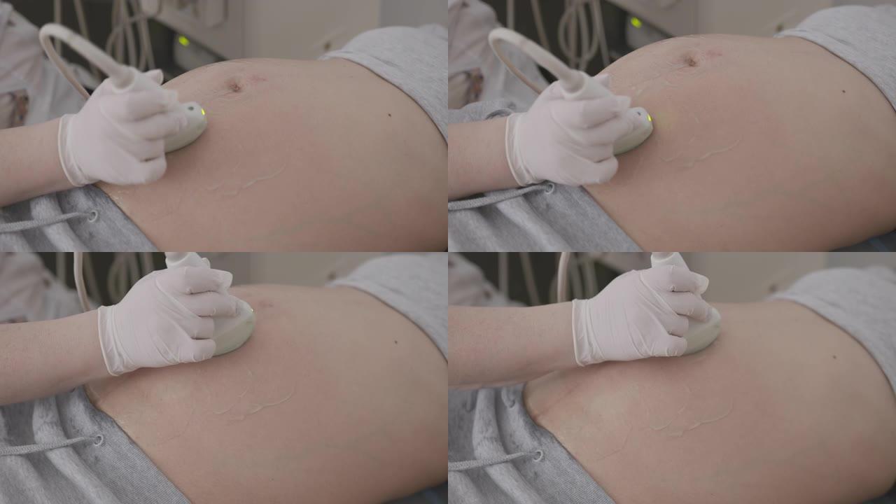 医生对孕妇做超声波、超声波检查。特写。