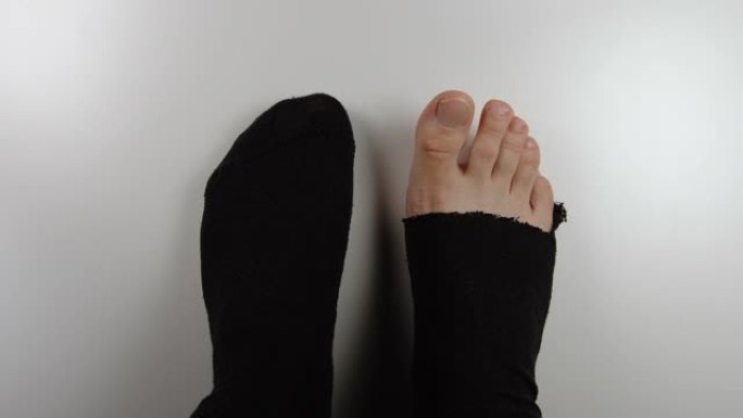 俯视图: 男性的腿，袜子有一个洞