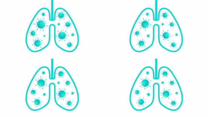 新型冠状病毒肺炎或电晕病毒在人的肺和呼吸系统。