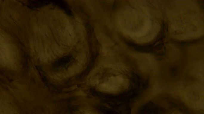 干燥皮肤的显微镜检查。放大150x，可见表皮细胞壁。缺乏水分概念。