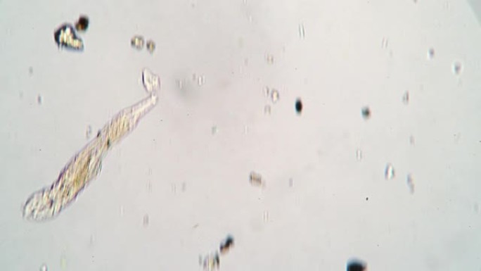 显微镜下池塘水滴中的微观动物轮虫