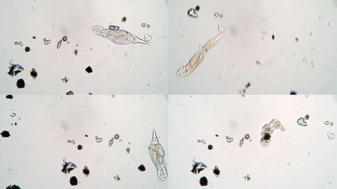 显微镜下池塘水滴中的微观动物轮虫