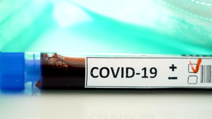 带有冠状病毒新型冠状病毒肺炎标志的试管套件